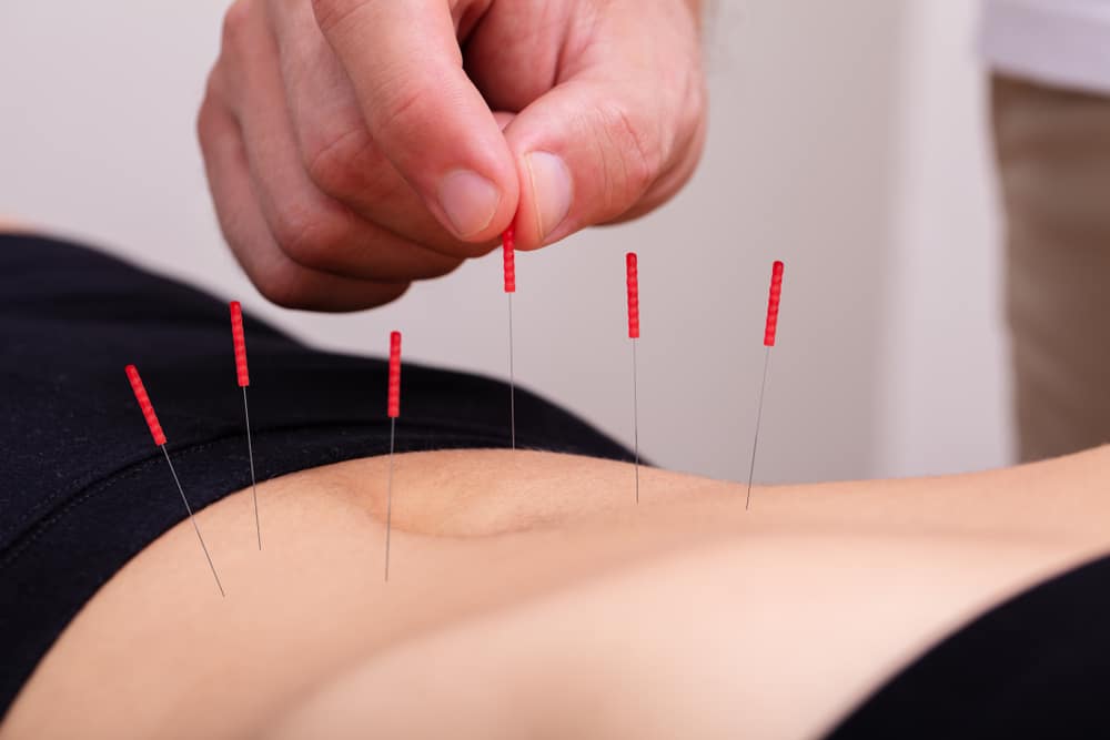 FAQ Acupuncture