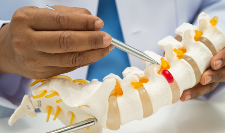 What to Expect from Chiropractic Care for Slipped Disc Pain