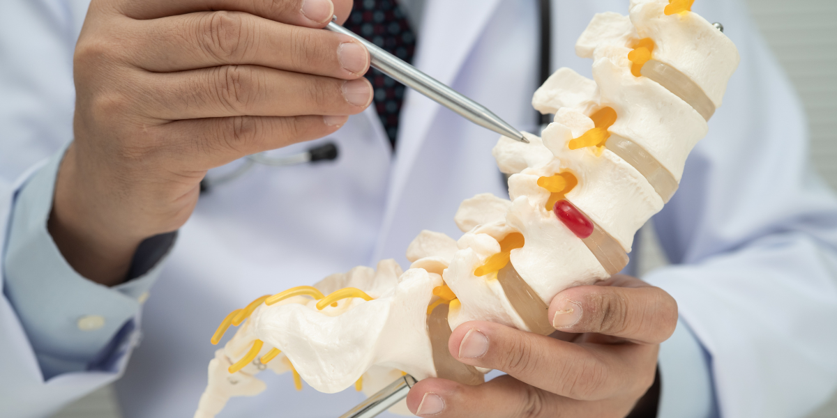 Understanding Spinal Misalignment and How It Develops