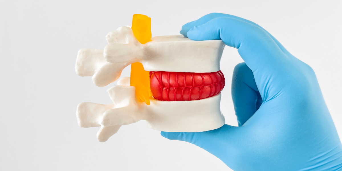 How Spinal Decompression Therapy Works for Herniated Discs